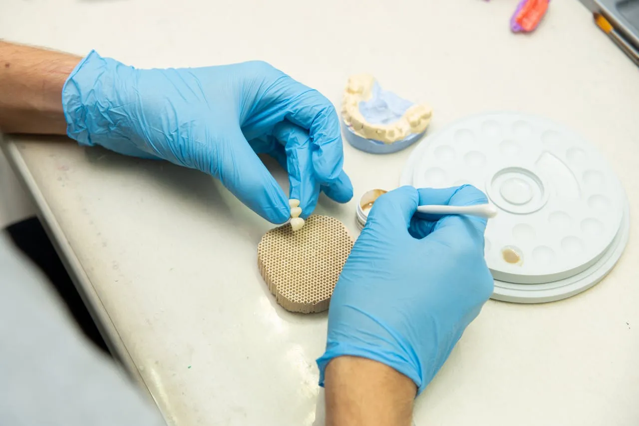Dental crown fabrication process in an Antalya dental laboratory — precision CAD/CAM crown production