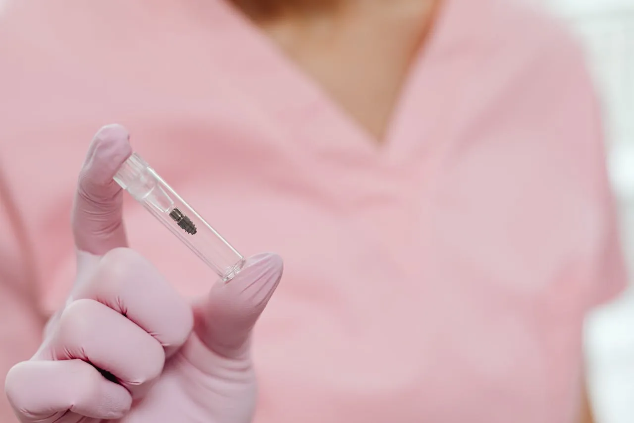 Premium titanium implant posts used in All-on-4 and All-on-6 procedures in Antalya, Turkey