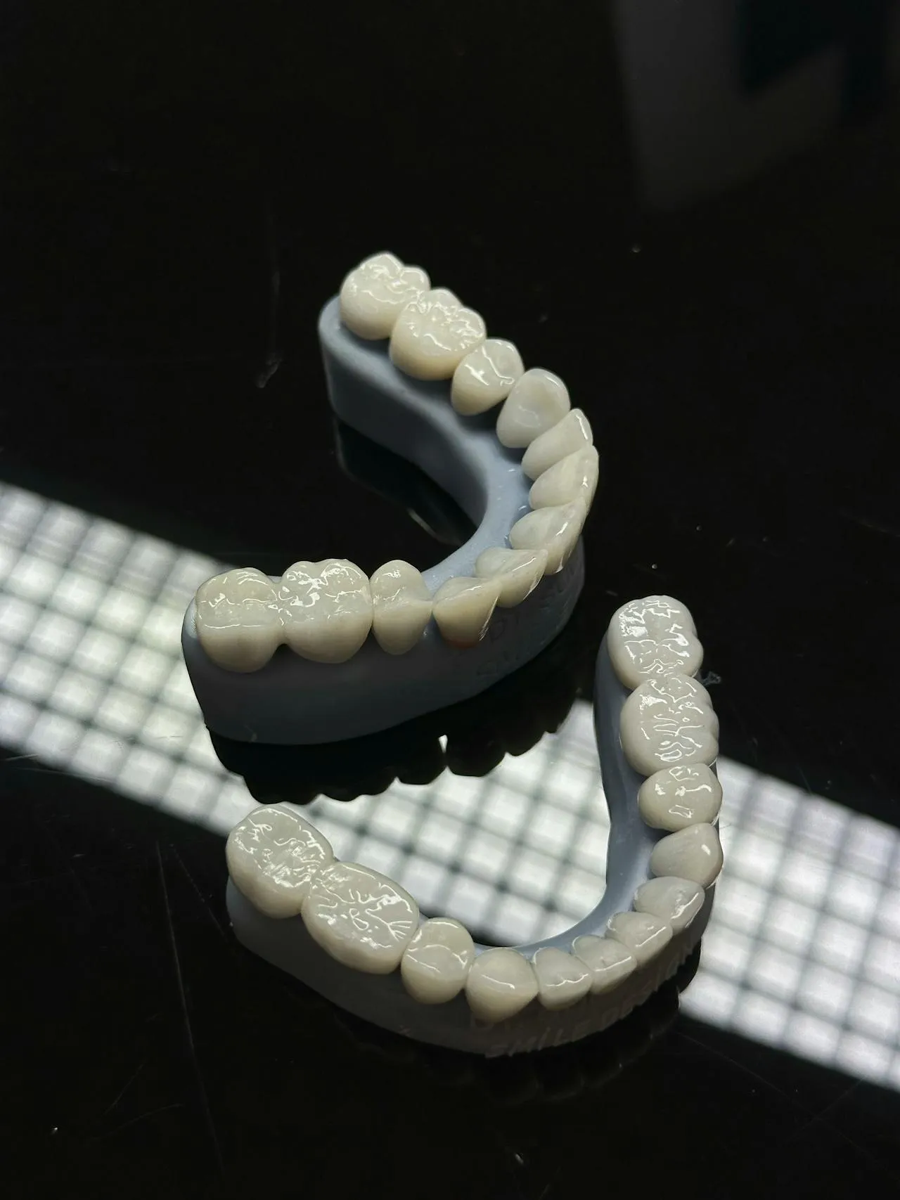 Porcelain veneer shells ready for fitting — ultra-thin E-max porcelain used for smile makeovers at top Antalya clinics